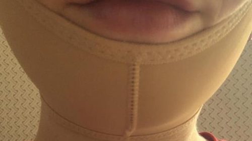 Click to view full screen Dr. Lipo+ V photo review