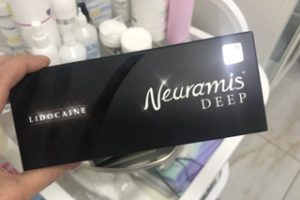 Neuramis Deep Lidocaine photo review