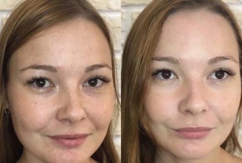 ASCE plus face photo review