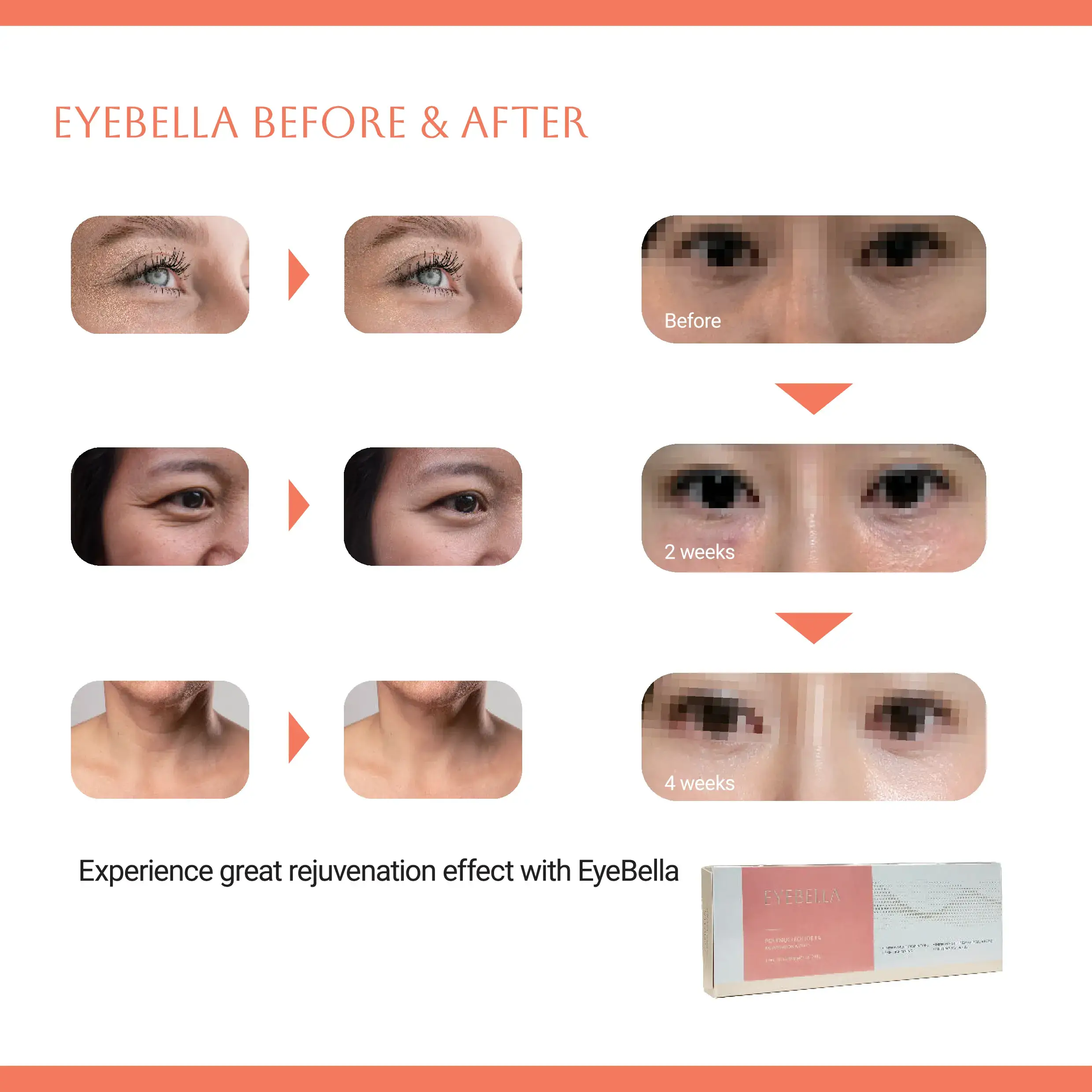 EYEBELLA