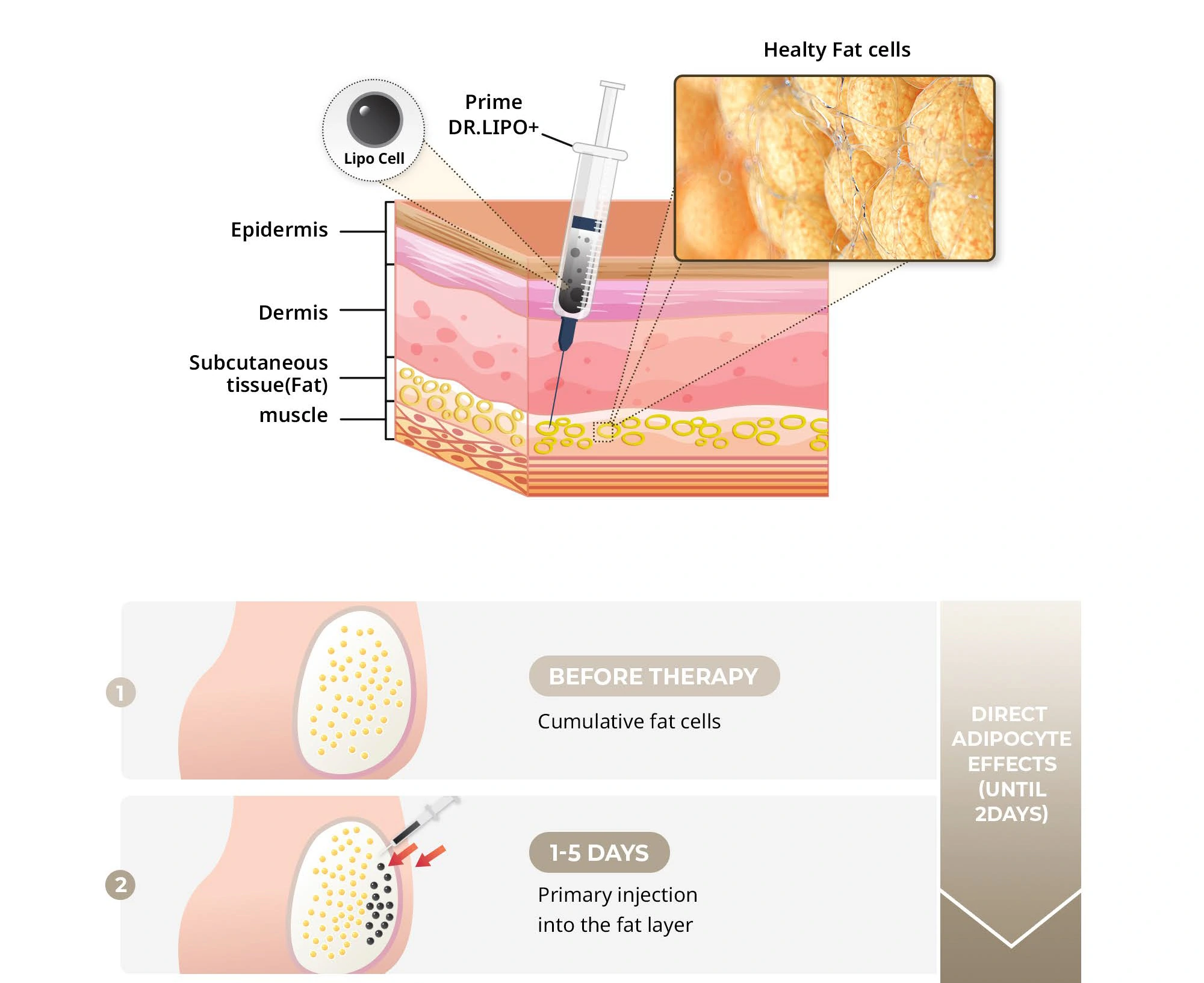 Prime DR. LIPO+