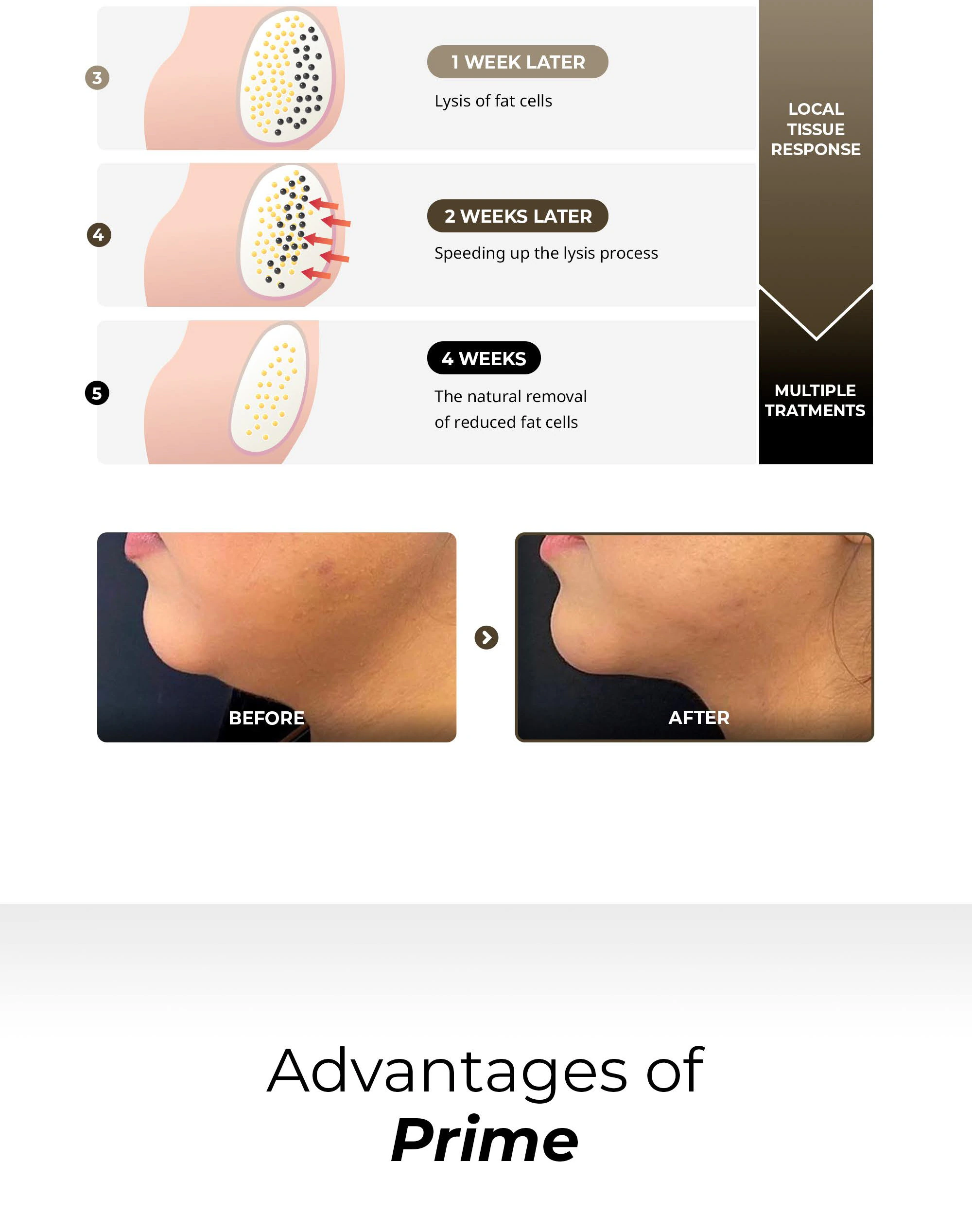 Prime DR. LIPO+